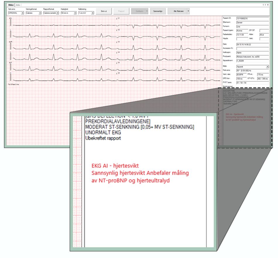 ekg-ill.jpg